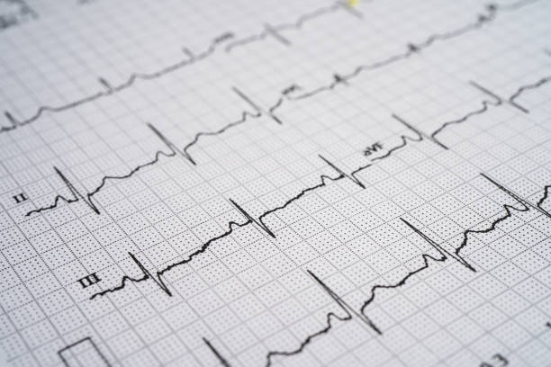 istock Electrocardiogram  ECG with red heart, heart wave, heart attack, cardiogram report. 1436155572