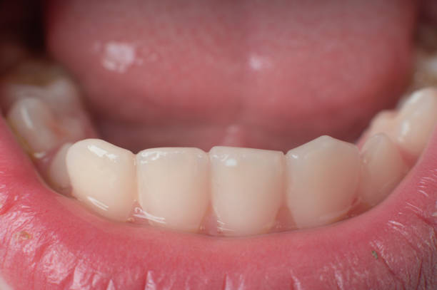 istock Jaw with children's straight teeth close-up. 1436160332