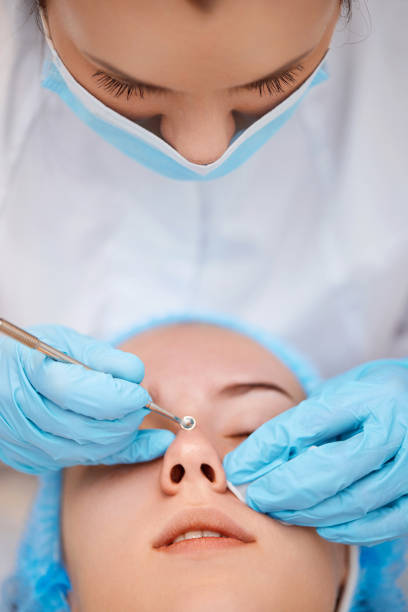 istock woman during a mechanical face cleansing procedure 1436279721