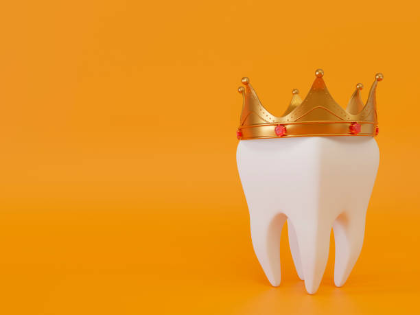 istock 3d realistic healthy tooth with crown on yellow background. 3d rendering illustration. 1436338195