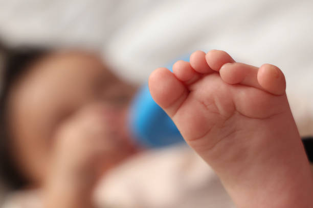 Polydactyly is a condition in which a baby is born with one or more extra fingers.