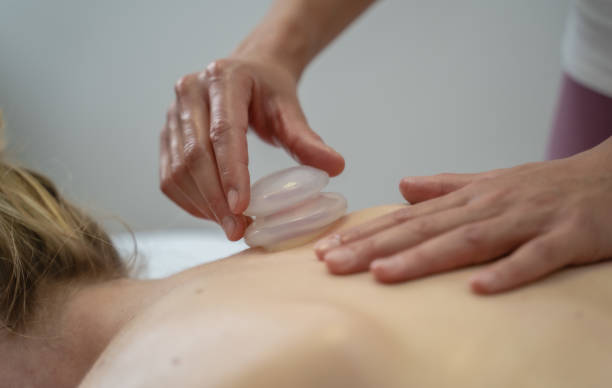 Massage cupping therapy massage cupping healing therapy vacuum cup pain glass feeling good regeneration rehabilitation cupping therapy stock pictures, royalty-free photos & images