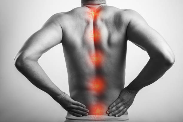 척추에 빨간 자국이있는 척수 해부학에 남성 셔츠가없는 신체 통증 - 고립 색상 뉴스 사진 이미지