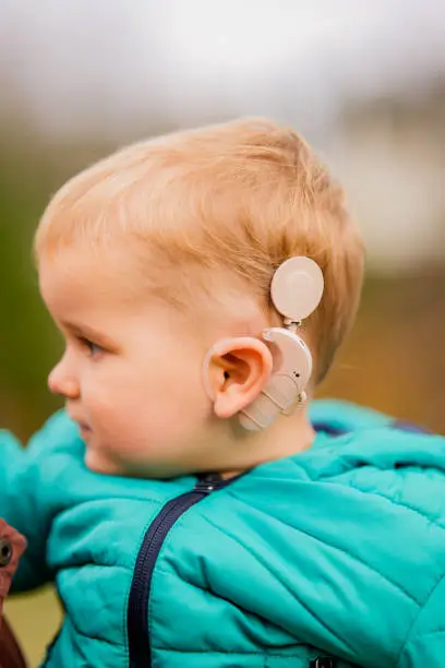 Photo of Shot of a baby with cochlear implants