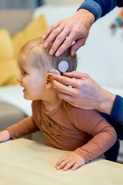 Photo of Shot of a deaf child with cochlear implants