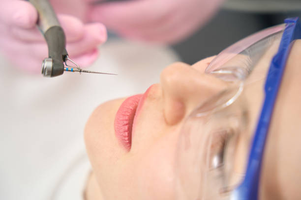 percer avec une longue perceuse près du visage du patient - dental hygiene dental equipment dental drill practicing photos et images de collection