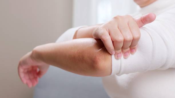 Young woman having pain in her elbow and using hand for self-massage to relieve aches and pains. Young woman having pain in her elbow and using hand for self massage to relieve aches and pains. Health care concept. forearm stock pictures, royalty-free photos & images