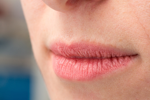 A closeup of a woman with pink chapped lips