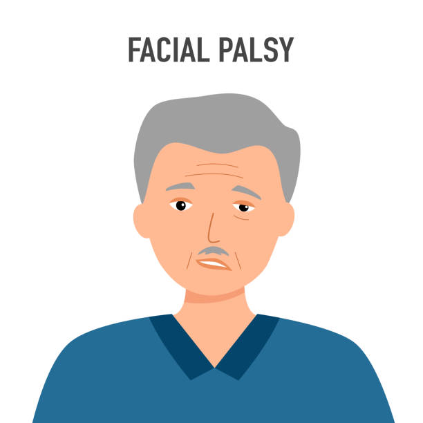 Senior facial nerve paralysis concept vector illustration. Face palsy. Senior facial nerve paralysis concept vector illustration. Face palsy. distorted face stock illustrations