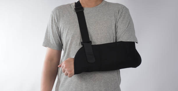 broken arm. arm sling therapy support and covered around elbow first knuckle broken arm. post operative care. fractures of humerus radius ulna scapula. arm sling after accident. isolated background. - arm sling imagens e fotografias de stock