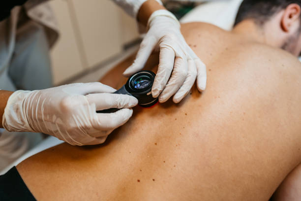 Female Doctor Examining Patients Birthmarks Female doctor examining patients birthmarks for skin cancer in a medical clinic. mole stock pictures, royalty-free photos & images