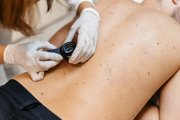 istock Female Doctor Examining Patients Birthmarks 1437090447