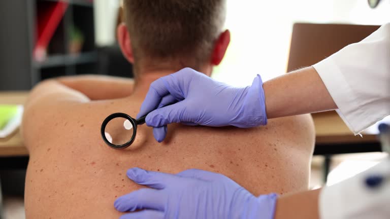 Doctor checking skin of male patient with magnifying glass on back