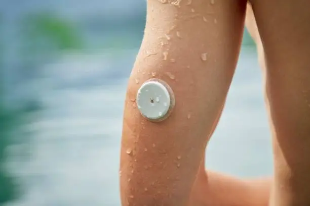 An arm of a diabetes patient against a swimming pool with a waterproof CGM (Continuous Glucose Monitor)