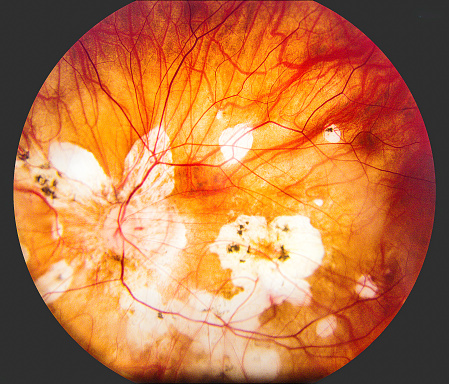Human Eye anatomy photo taking with Retina Camera.
