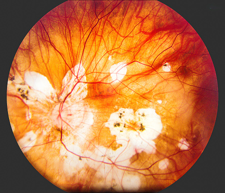 Closeup brown eye of caucasian 74 year old woman, front view, full frame horizontal composition