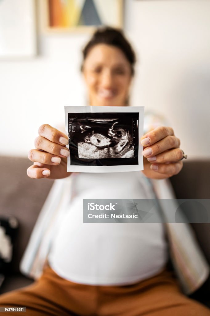 A pregnant woman holds an ultrasound image looking at camera A pregnant woman holds an ultrasound image Ultrasound Stock Photo