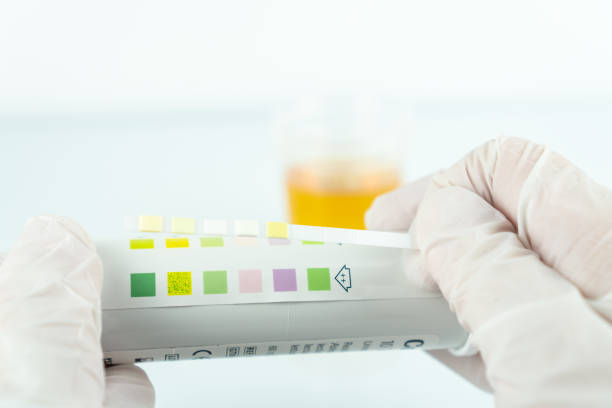 istock Closeup shot of a bottle for urine analysis strips 1437719354