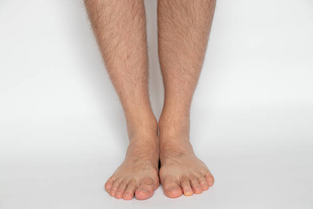 Men's legs on a white background close-up, health stock photo
