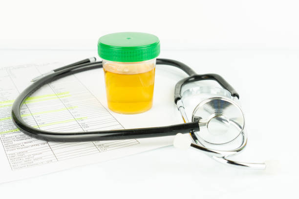 istock Closeup shot of routine urinalysis and  stethoscope 1437872393