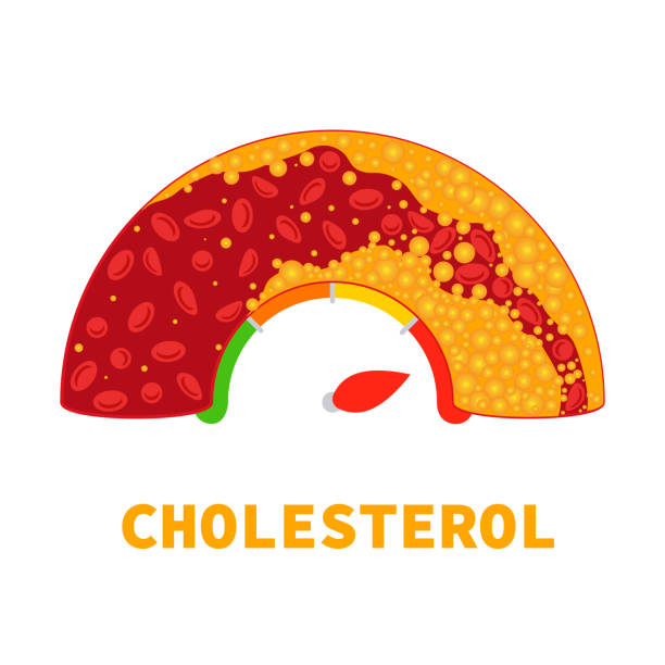 Cholesterol level meter gauge with blood vessel diagram Cholesterol level on blocked blood vessel medical diagram. Meter gauge of bad hdl lipoprotein. High and low fat test indicator. Atherosclerosis risk. Healthcare concept. Vector illustration. clogged artery stock illustrations