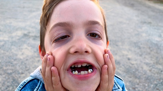 Smiling little boy looking at the camera showing his teeth