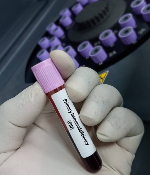 tecnologo medico in possesso di campioni di sangue per il test di immunodeficienza primaria (pid) in laboratorio. - immunodeficiency foto e immagini stock