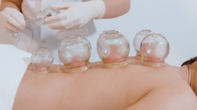 Beautiful Woman Received cupping treatment on back by  therapist, chinese medicine treatment, health and healing concept.
