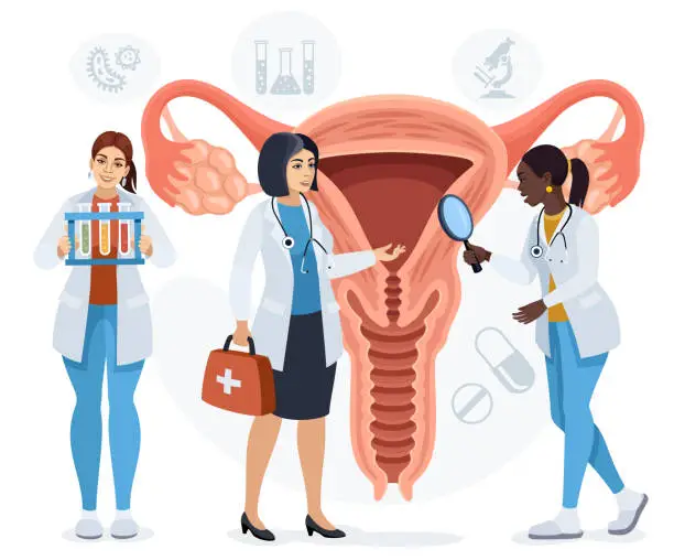 Vector illustration of Gynecologists examining uterus.