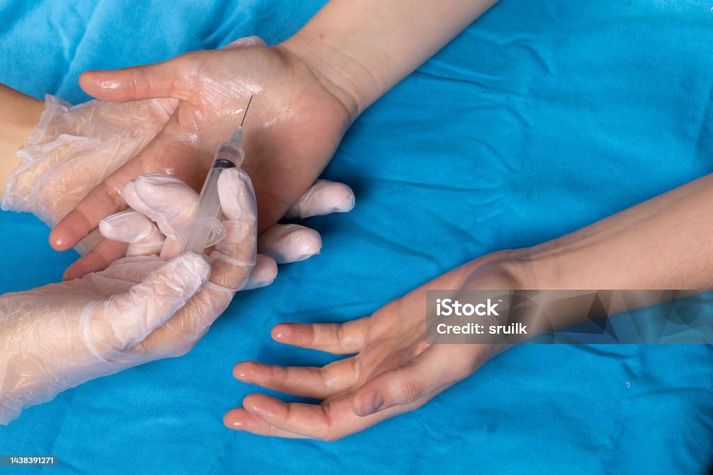 how to relieve palmar hyperhidrosis: symptoms and how to cure it Hyperhidrosis Stock Photo