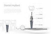 3d-zahnimplantate-chirurgie-konzept-mit-