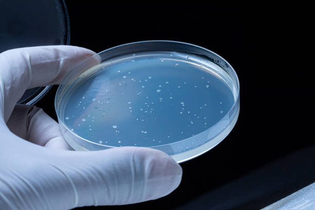 istock Petri dish with bacterial colonies on agar 1438600661
