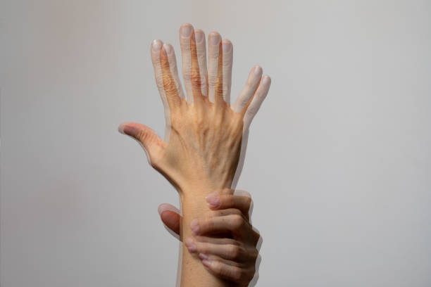 diplopia, double perception of an image on woman hand