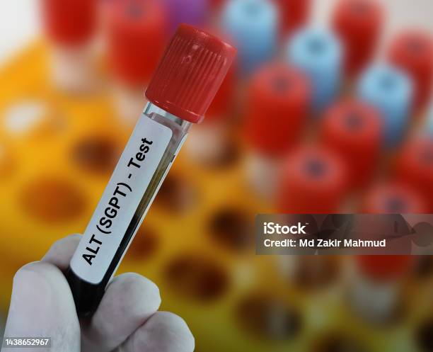 Alt Lab Blood Sample For Alt Test Liver Function Test Stock Photo - Download ...