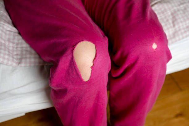 Children's pink house pants are torn at the knees Children's pink house pants are torn at the knees. Girl's legs in old worn pants hole in pants stock pictures, royalty-free photos & images