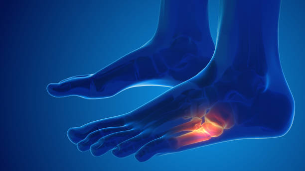 istock Broken foot bone pain medical concept 1438877247