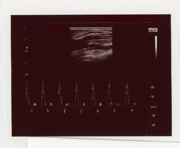 istock ultrasonic diagnostic sonography 1439022999
