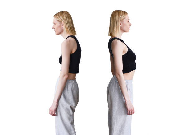 Comparison of bad and good posture. Woman slouching and straightening Comparison of bad and good posture. Woman slouching and straightening. kyphosis stock pictures, royalty-free photos & images