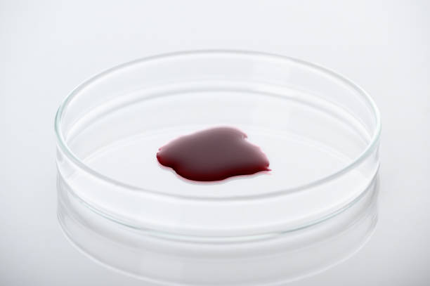 primo piano del campione di sangue o liquido chimico rosso sulla capsula di petri nel laboratorio medico - analisi e concetto diagnostico - su sfondo bianco - petri dish medical equipment syringe vaccination foto e immagini stock