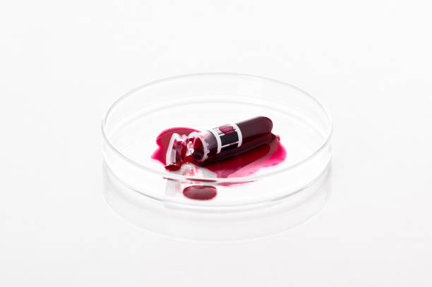 provetta di campione di sangue rotta o schizzo liquido rosso su una capsula di petri in laboratorio - analisi e concetto diagnostico - isolato su sfondo bianco - petri dish medical equipment syringe vaccination foto e immagini stock