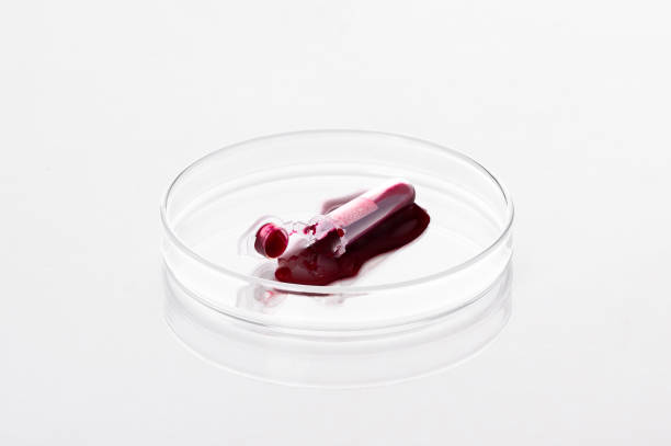 provetta di campione di sangue rotta o schizzo liquido rosso su una capsula di petri in laboratorio - analisi e concetto diagnostico - isolato su sfondo bianco - petri dish medical equipment syringe vaccination foto e immagini stock