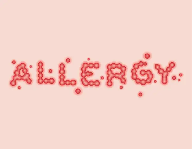 Vector illustration of Allergy lettering. Pimple lettersTypography. Acnea whelk typography Vector illustration