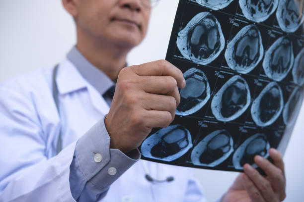 Orthopedics surgeon doctor examining patient's knee joint x-ray films, MRI bone, CT scan in at radiology orthopedic unit in hospital. knee joint film x ray, close up médico cirujano ortopédico que examina las películas de rayos x de la articulación de la rodilla del paciente, resonancia magnética del hueso, tomografía computarizada en la unidad ortopédica de radiología en el hospital. radiografía de la pelícu