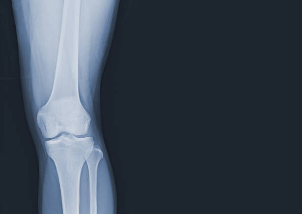 bande dessinée du genou humain des articulations et des ligaments normaux du genou humain concept d’image médicale. - x ray human knee orthopedic equipment human bone photos et images de collection