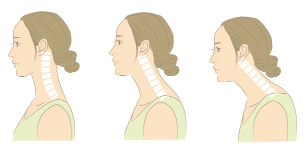 Woman with normal cervical spine and straight neck Woman with normal cervical spine and straight neck human neck illustrations stock illustrations