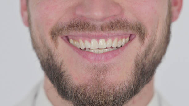 istock Smiling Lips of Young Man on White Background 1439576401