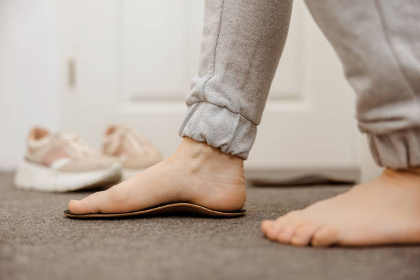 istock Flat feet diagnosis and orthotics, shoe inserts. Problems with flatfoot, pain. Identification of flat foot. Treatment to plantar fasciitis. Womans foot and insoles at home, close up view. 1439684871