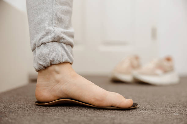 istock Flat feet diagnosis and orthotics, shoe inserts. Problems with flatfoot, pain. Identification of flat foot. Treatment to plantar fasciitis. Womans foot and insoles at home, close up view. 1439684885
