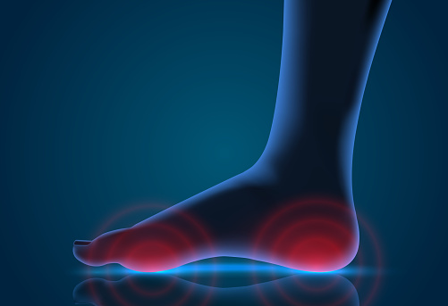 vector human foot. blue contour and red spots of pain. ready element for medicine and orthopedics