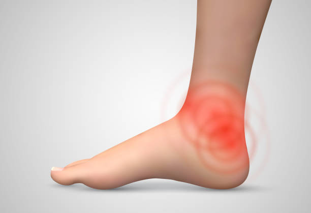 istock vector human foot.red spots of pain. ready element for medicine and orthopedics 1439715103